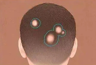 ͷƤͺһô3ɣʶ